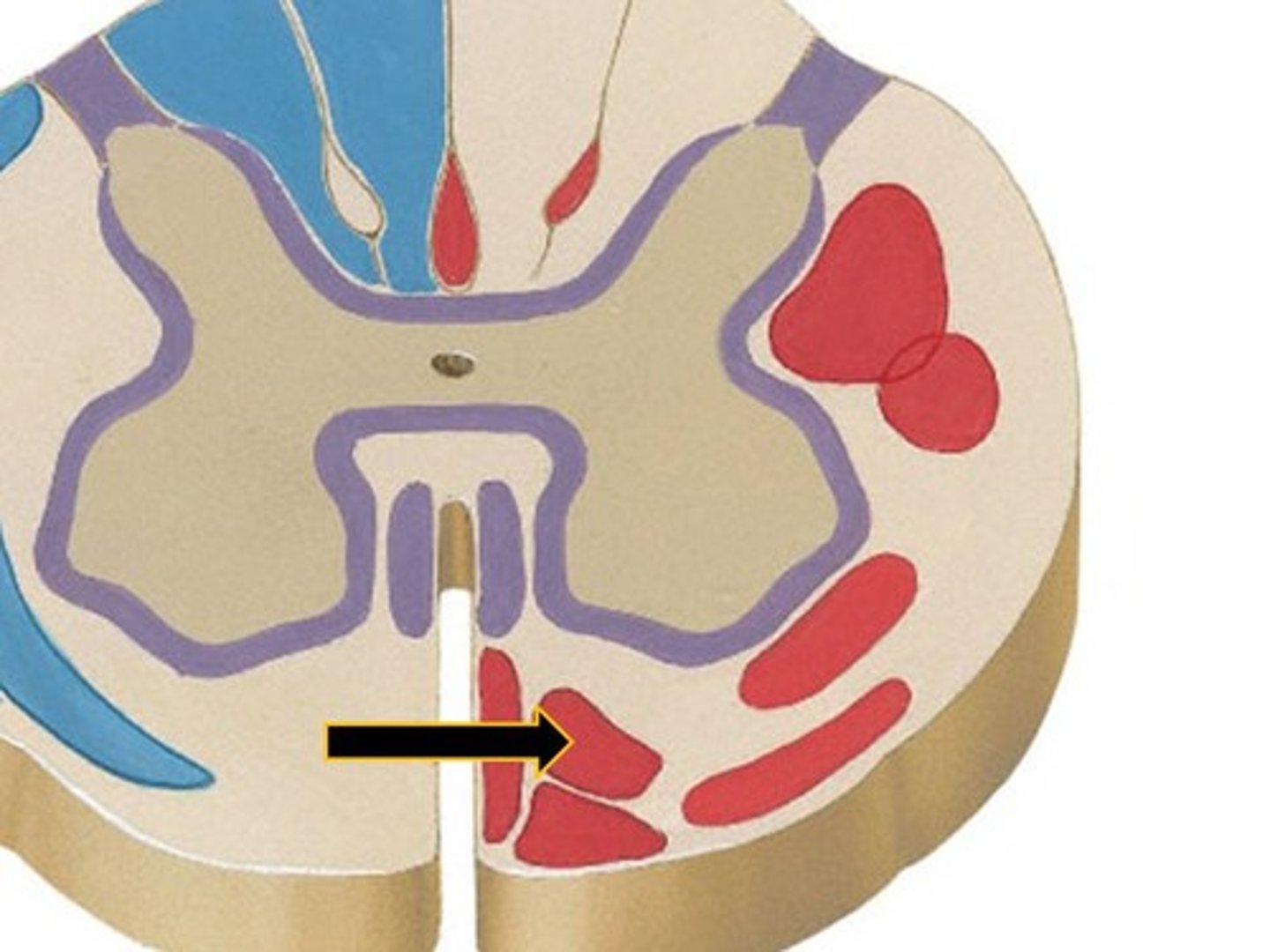 <p>-a tract of axons arising from the brainstem reticular formation and descending to the spinal cord to modulate movement</p><p>-bilateral postural control and gross limb movement</p><p>-whole brainstem</p>