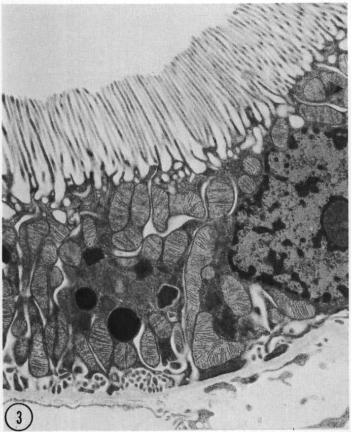 <p>State and explain what part of the kidney this micrograph shows?</p>