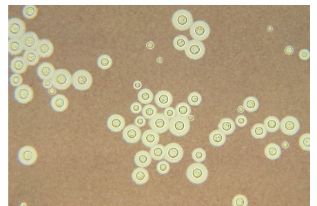 <p>-infections caused by yeasts from the genus Cryptococcus</p><p>-species: C. neoformans and C. gattii</p><p>-appears as large encapsulated yeast</p>