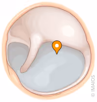 <p>what part of the ear is this</p>