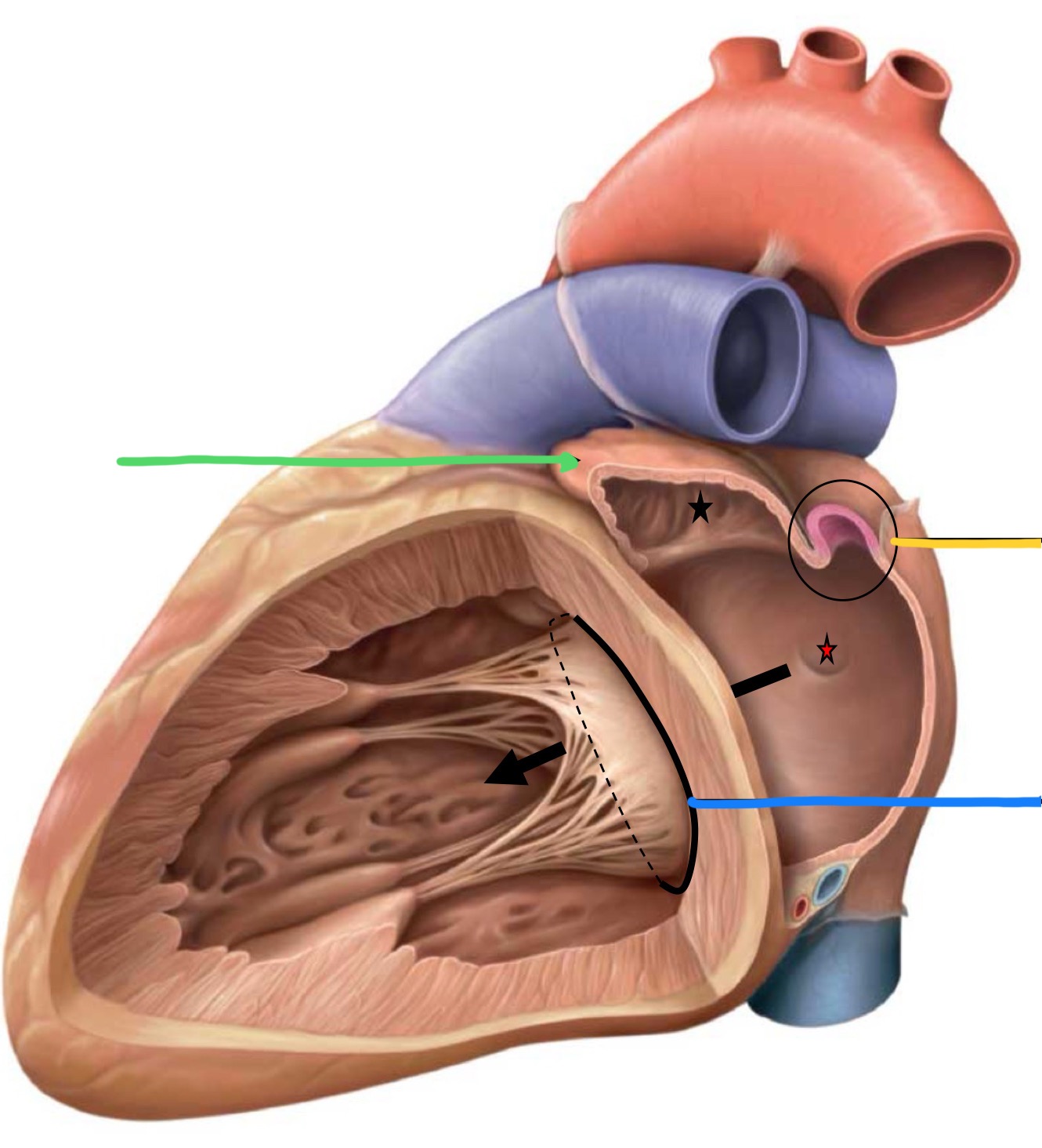 <p>What structure is identified by the yellow line?</p>
