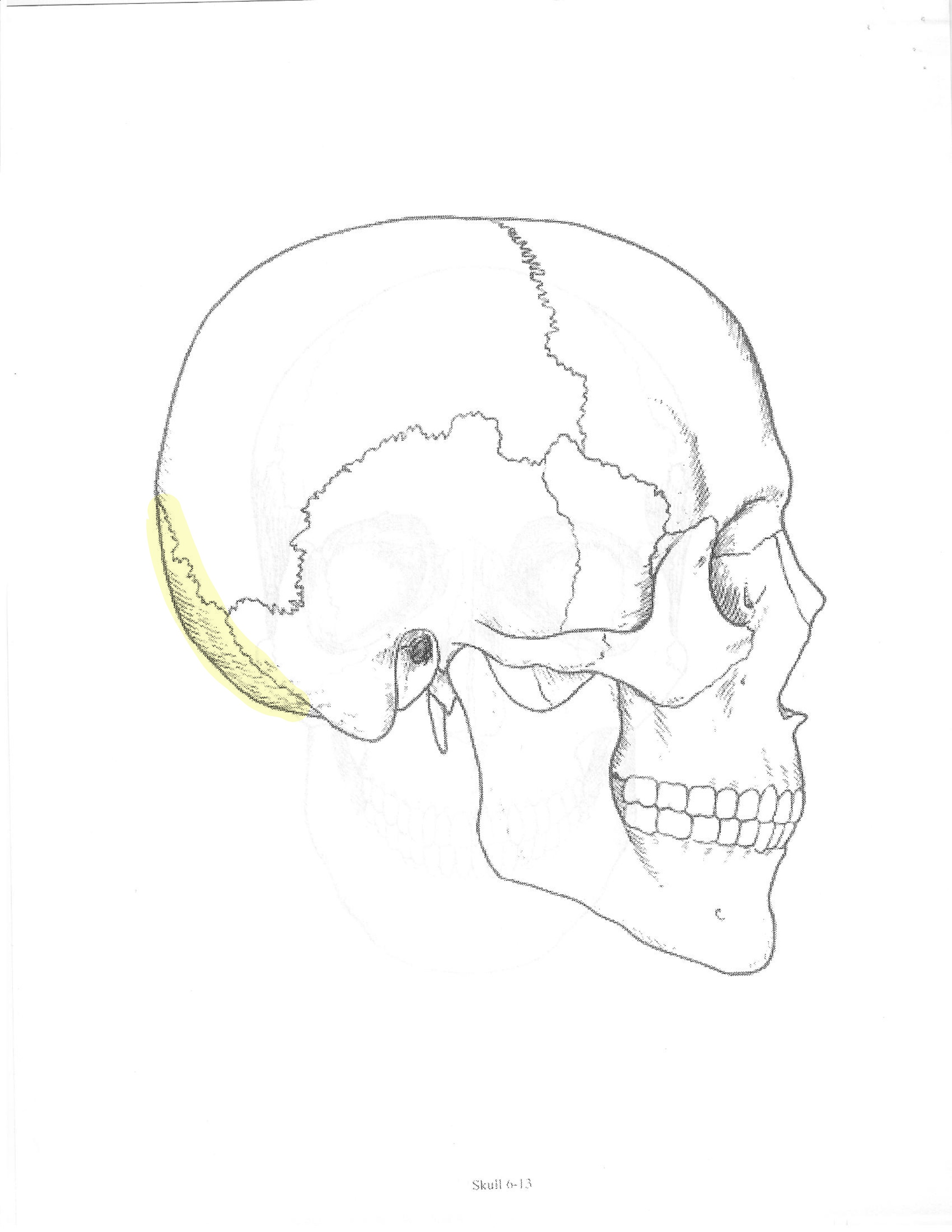<p>ID bone</p>