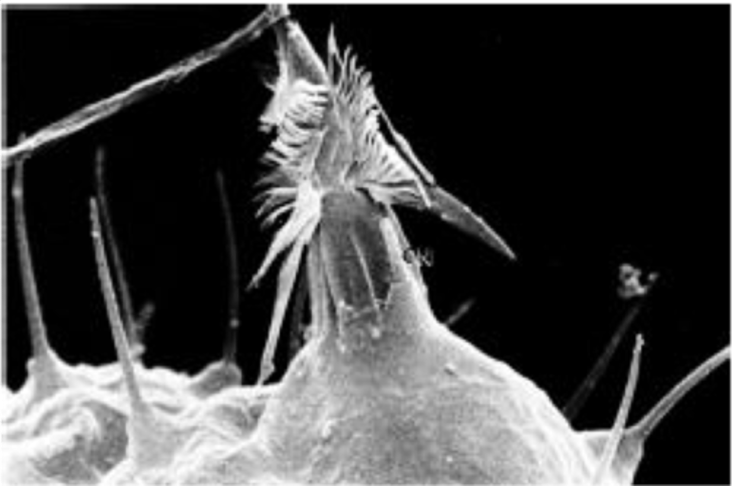 <p>Discharged nematocyst</p>