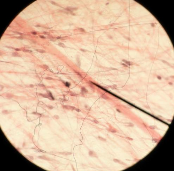 <p>Tissue locations</p>