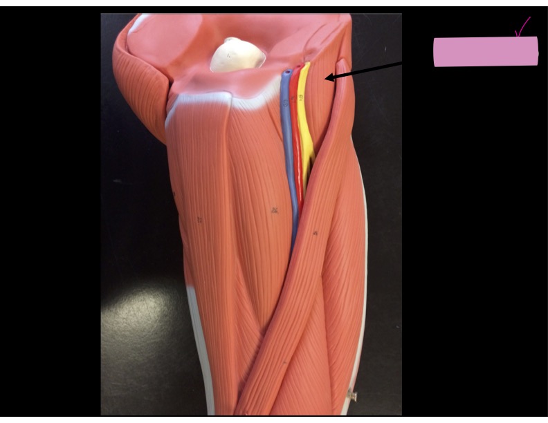 <p>Identify the muscle:</p>