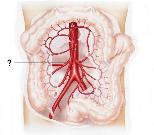 term image