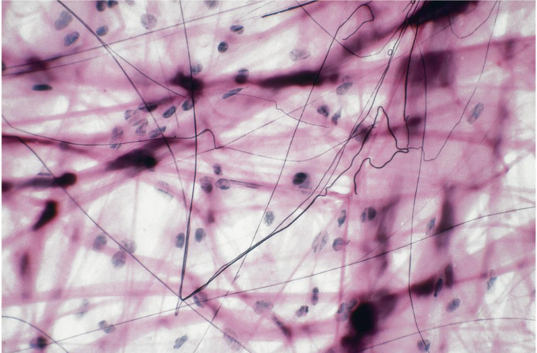 <p>what tissue is this</p>