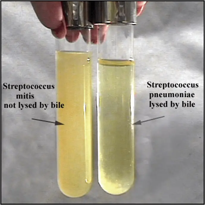 <p>S. Pneumoniae</p>