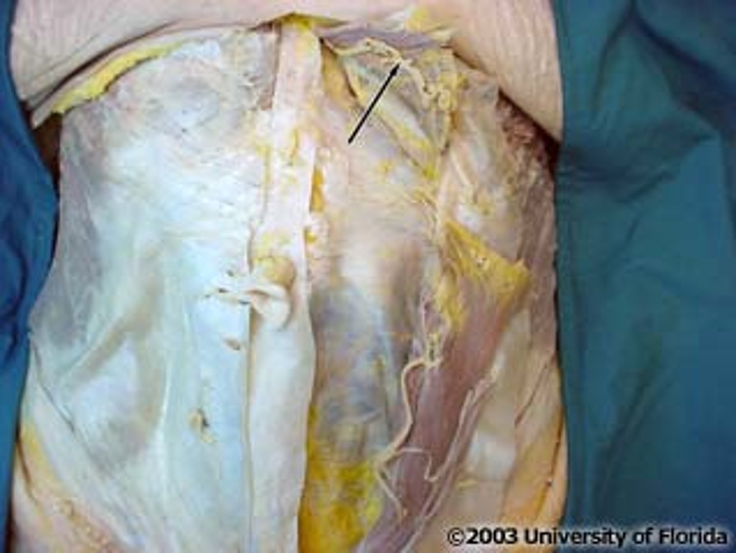 <p>artery</p>
