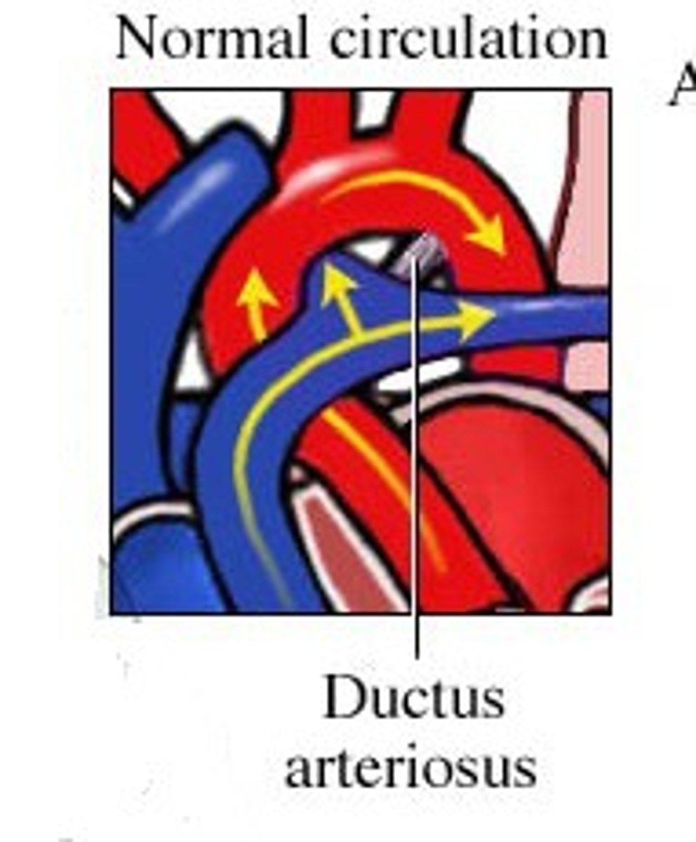 <p>A structure in embryo connecting the pulmonary trunk to the aorta.</p><p>Acts as a shunt - prevents blood from going back to lungs and instead dumps it back into aorta.</p>