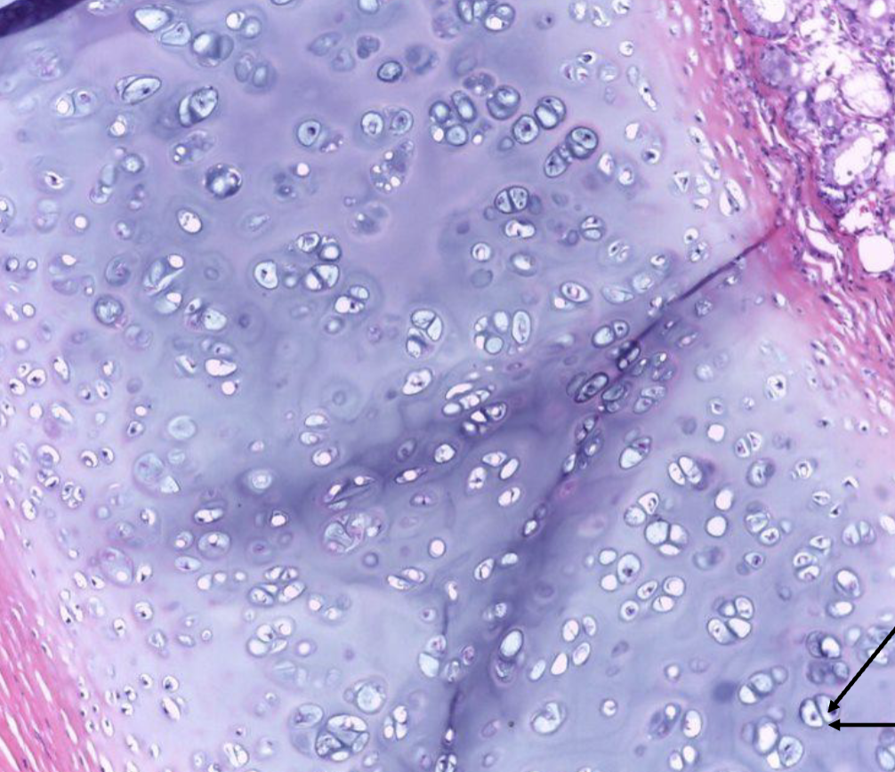 <ol><li><p><strong>Name the tissue type</strong></p></li><li><p><strong>Name the cell type</strong></p></li><li><p><strong>What does the cell sit inside?</strong></p></li></ol><p></p>