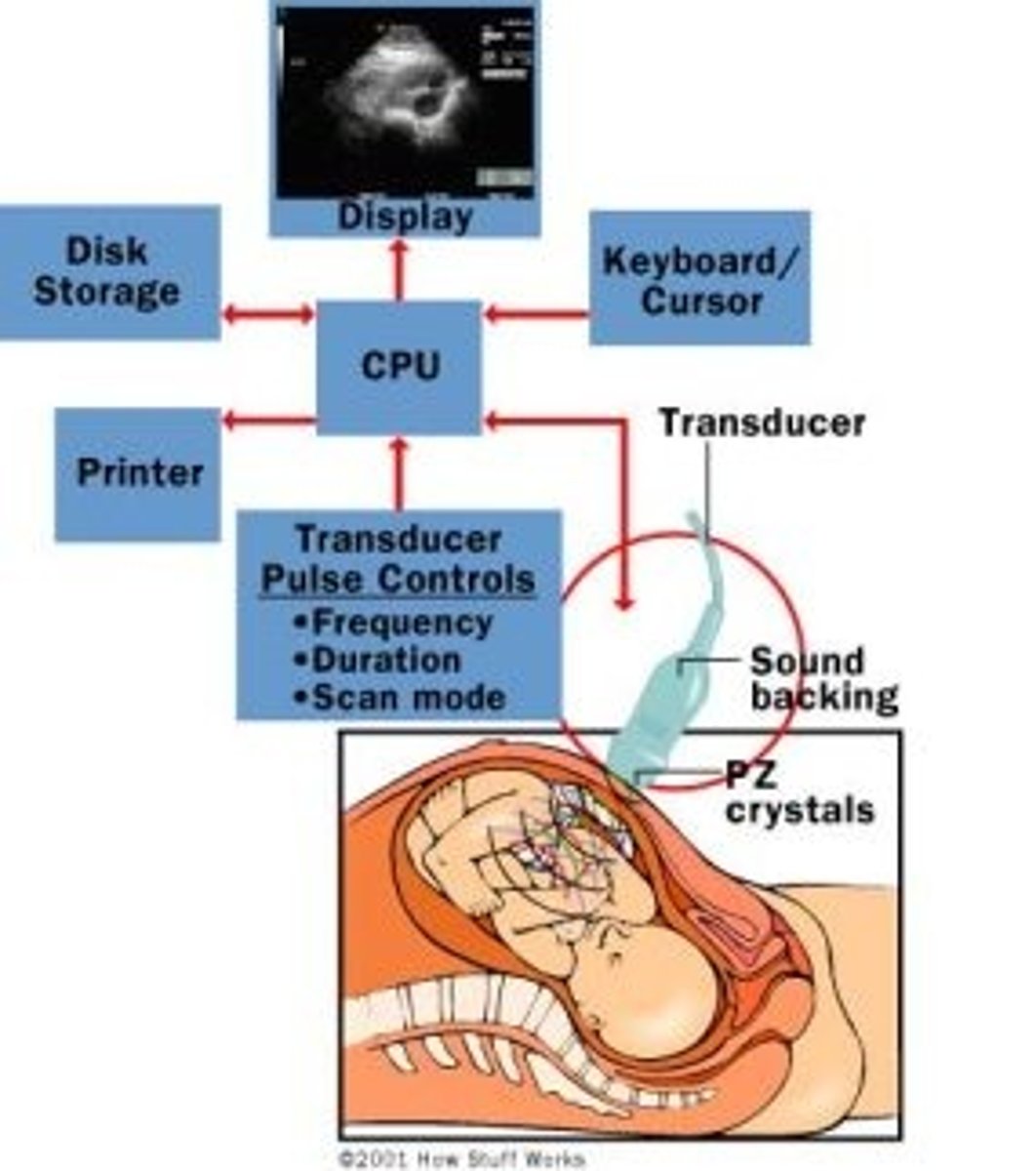 <p>It uses Ultrasound frequency sound waves to determine the structure of body tissues. It is based on the idea that sound waves will reflect upon hitting the interface between two mediums. The detector uses the speed of sound and the amount of time it took the wave to reflect back to calculate the location of that object.</p>