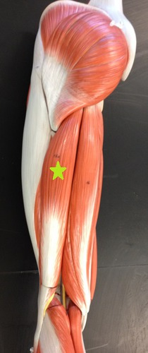 <p>Identify the Muscle.</p><img src="https://knowt-user-attachments.s3.amazonaws.com/f27130e7-d2cd-453c-a5d3-06dd378b7750.png" data-width="50%" data-align="center" alt="knowt flashcard image"><p></p>