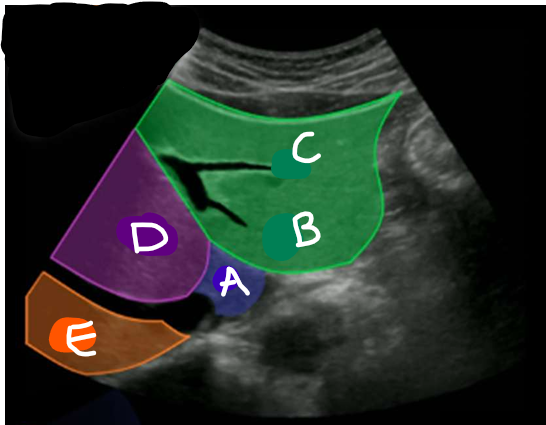 <p>B</p>