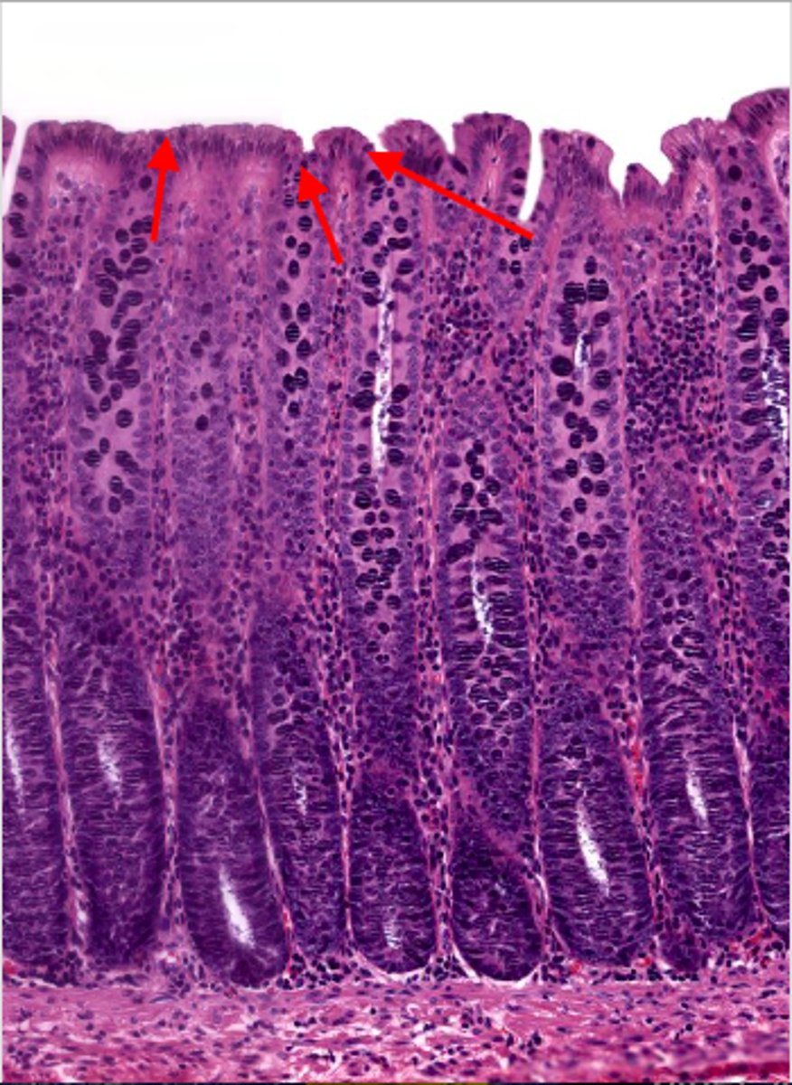 knowt flashcard image