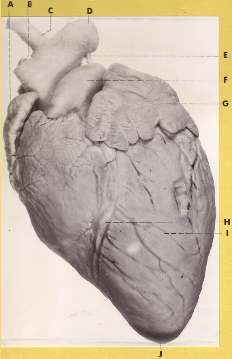 <p>D</p><p>(pig heart)</p>