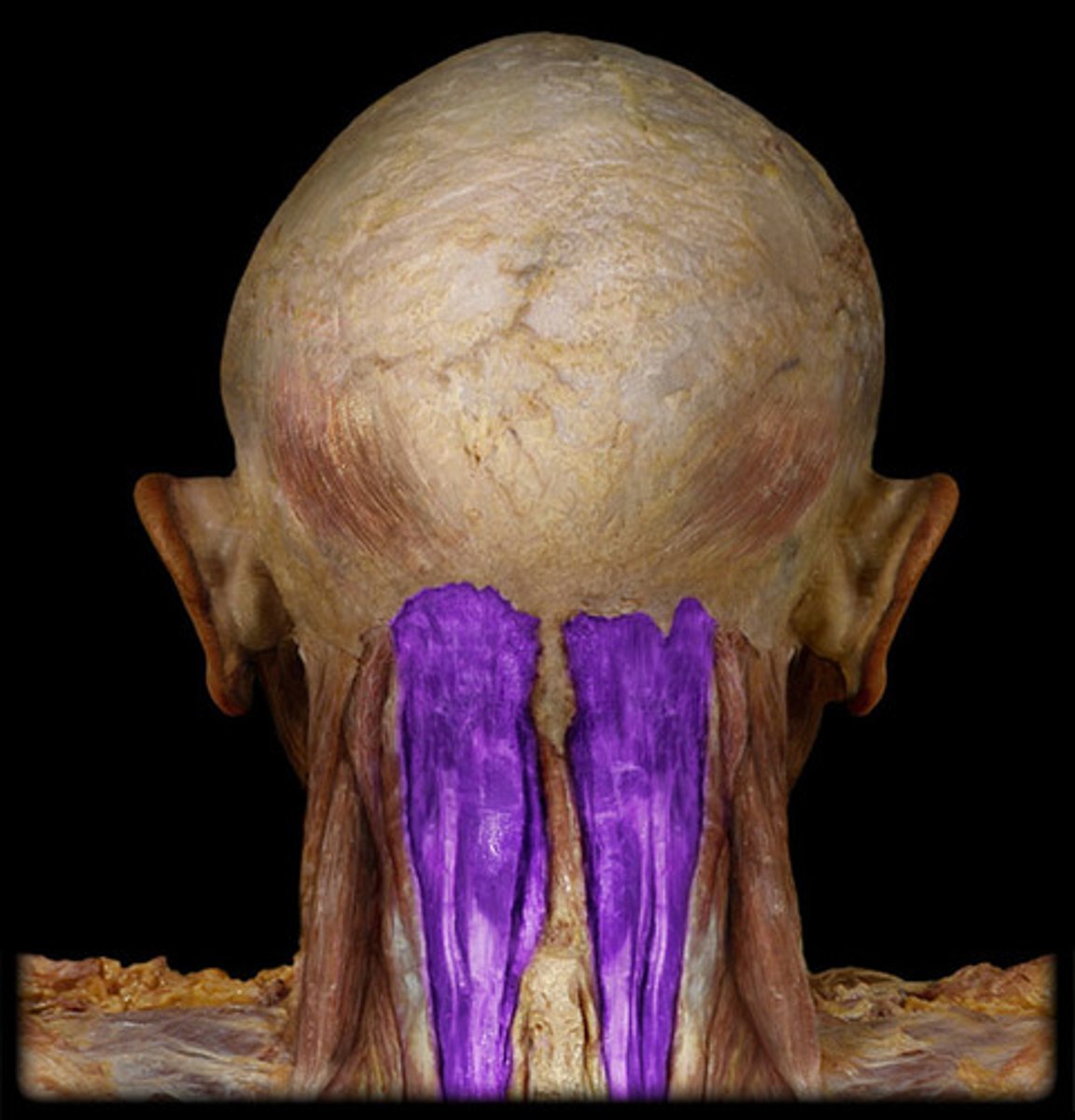 <p>between superior and inferior nuchal lines of occipital bone</p>