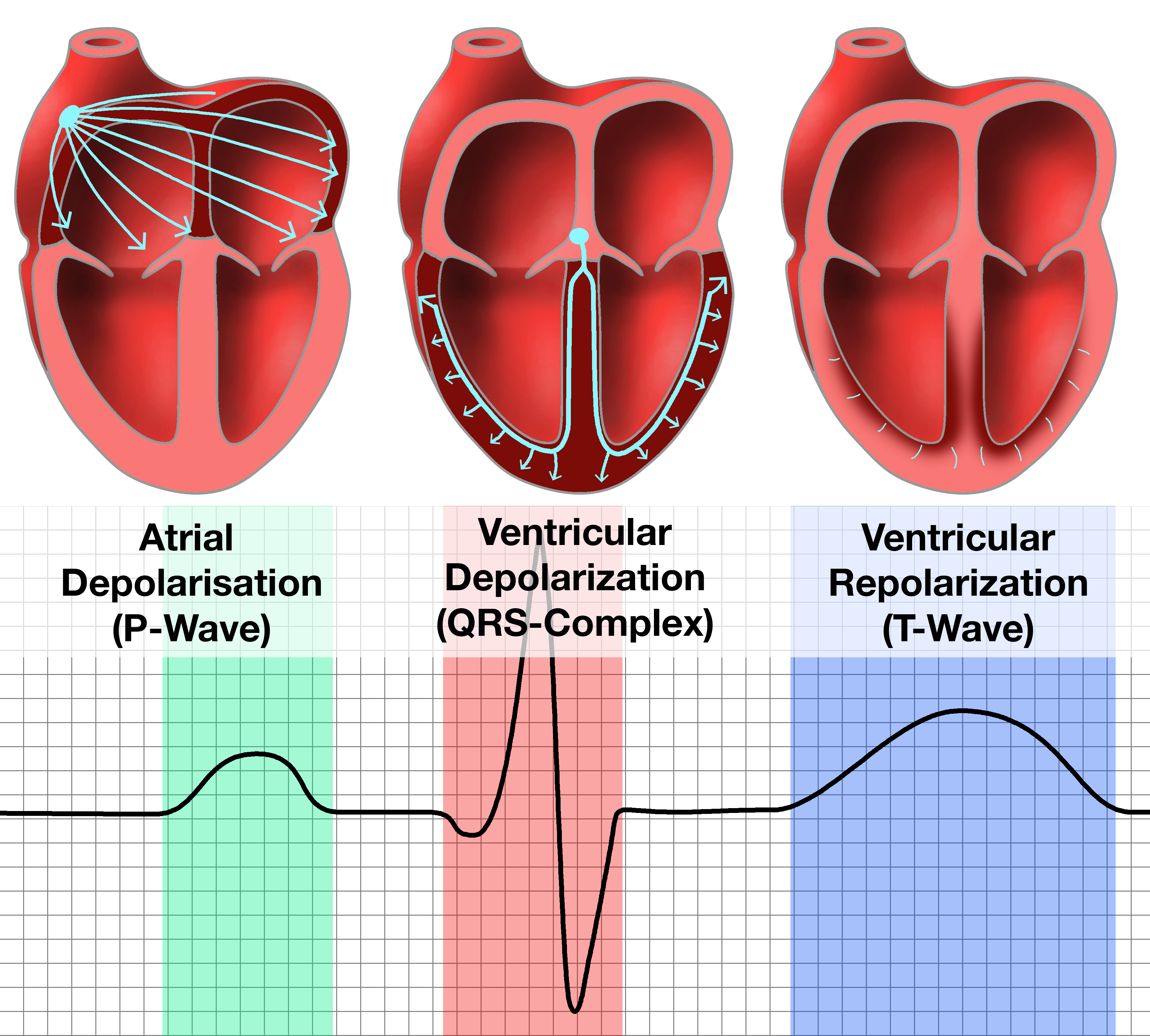 <p>p wave </p>