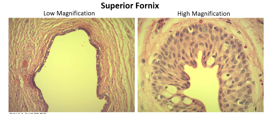 <ul><li><p>unicellular glands secret mucus layer of the tear film via apocrine secretion</p></li><li><p>non-uniform distribution- most abundant in forniceal conjunctiva and nasal bulbar conjunctiva; sparse near limbus and lid margin</p></li></ul><p></p>