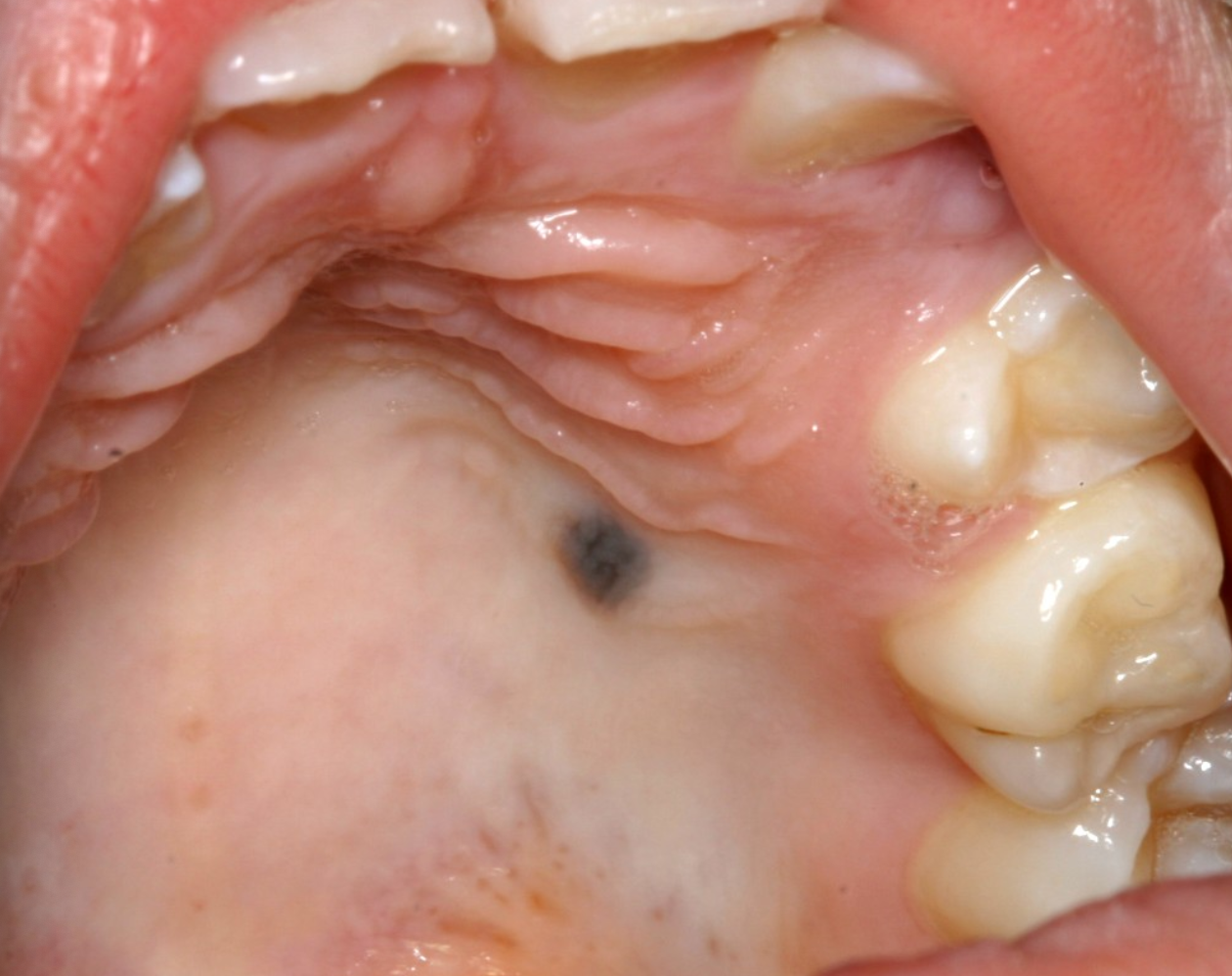 <p>9c. What would be the management?</p>