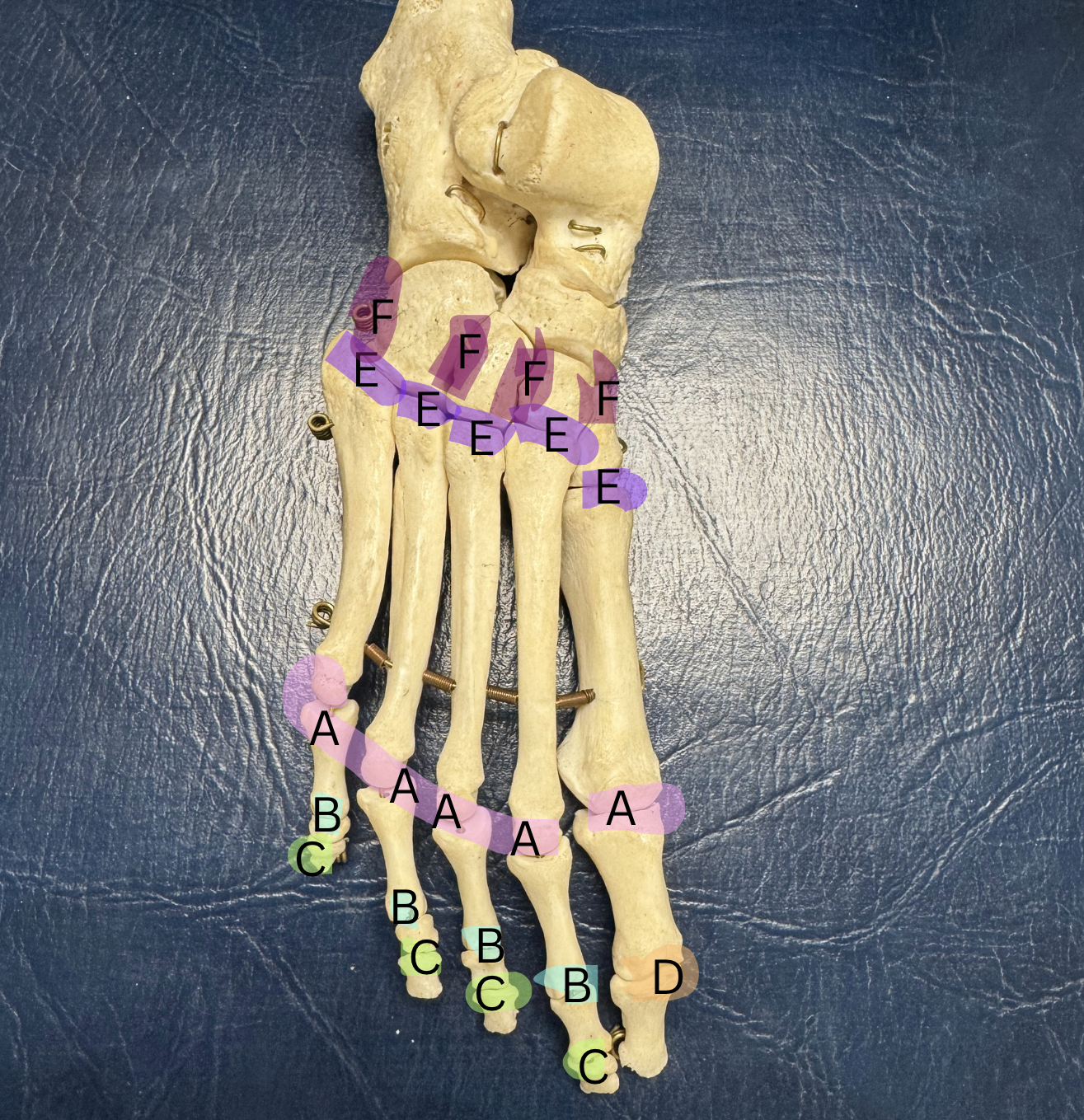 <p>Label these joints A-F</p>