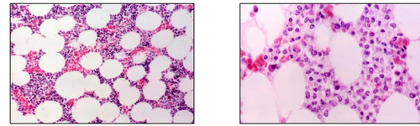 <p>A narrow, cylindrically shaped solid piece of bone marrow which maintains its structural integrity</p>