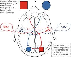 <p>Contralateral organization</p>