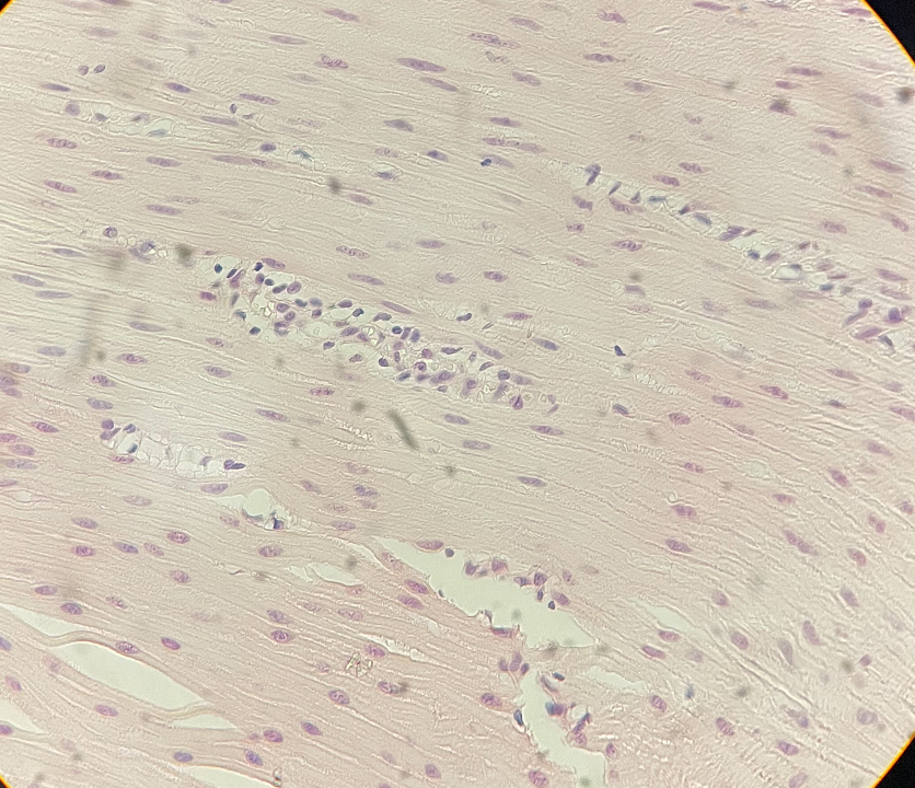 <p>Smooth muscle.</p>