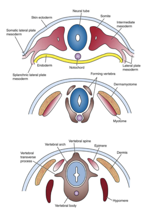 <p><strong>De embryologie</strong><br>Al voor het ontstaan van de neurale groeve en de neurale buis vormt zich aan de ventrale zijde in het mesoderm het notochord, ook wel de <strong>chorda dorsalis</strong> genoemd. Hiernaast ligt het <strong>paraxiaal mesoderm</strong>. </p><ul><li><p><mark data-color="#d8f8f0" style="background-color: rgb(216, 248, 240); color: inherit;">Het paraxiaal mesoderm verdikt zich en vormt </mark><strong><mark data-color="#d8f8f0" style="background-color: rgb(216, 248, 240); color: inherit;">somieten</mark></strong><mark data-color="#d8f8f0" style="background-color: rgb(216, 248, 240); color: inherit;">.</mark> </p></li><li><p>Somieten zijn de structuren die in longitudinale richting de wervellichamen gaan vormen.</p></li><li><p> <strong>Uit somieten ontstaan sclerotomen, myotomen en dermatomen</strong>. Allereerst zal er in de somieten een holte gevormd worden, en zullen de somieten zich meer gaan uitstrekken naar ventraal en dorsaal, om de neurale buis heen.</p></li><li><p> Vervolgens zullen de somieten aan weerszijden zich splitsen in een ventraal en dorsaal deel, waarbij het ventrale deel uitgroeit om volledig om het notochord heen te gaan liggen, zie het rechter plaatje hieronder.</p></li><li><p> <u>De dorsale en ventrale delen samen zorgen daarnaast voor de vorming van de wervel rondom de neurale buis, het ruggenmerg.</u></p></li><li><p>In het eindstadium in de afbeelding zie je dat de somieten volledig om het notochord en het ruggenmerg liggen. De twee ventrale delen hebben het <strong>wervellichaam</strong> gevormd, en de twee dorsale delen de <strong>wervelboog</strong>.</p></li></ul><p></p>