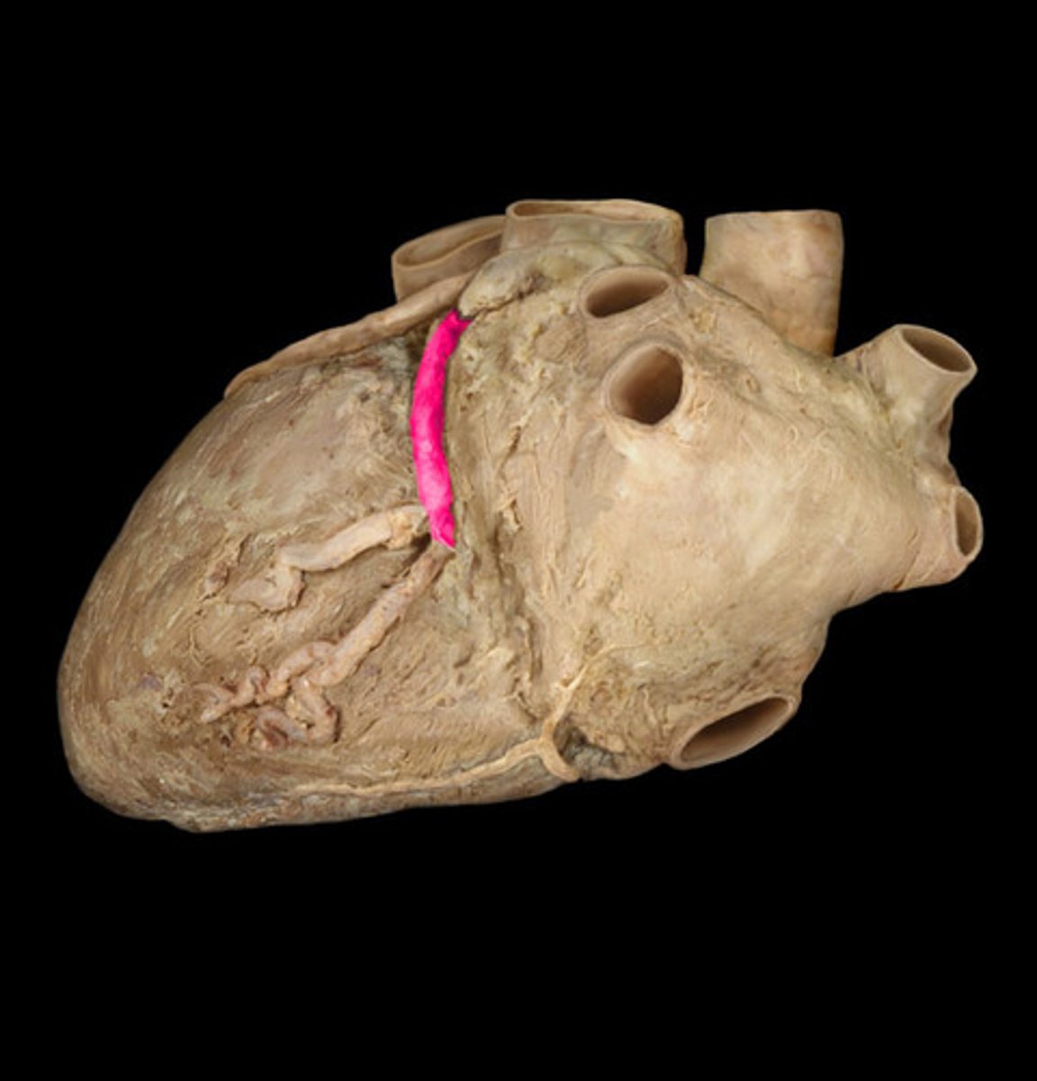<p>Name the Artery</p>