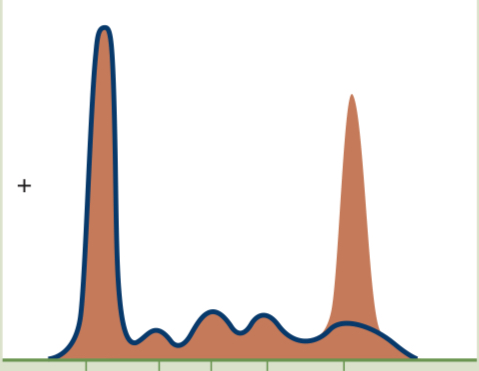 <p>Spike at Gamma (ɣ) globulin peak</p>