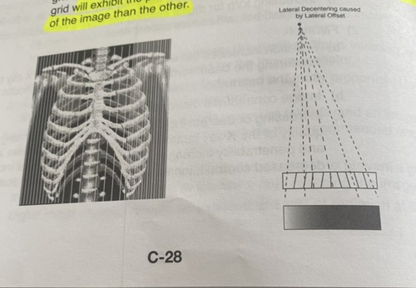 <p>Lateral off-centering of the central ray to a focused grid angulation of the central ray across the transverse axis of a focused grid will exhibit the presence of lead strips of more frequency on one side of the image than the other</p>