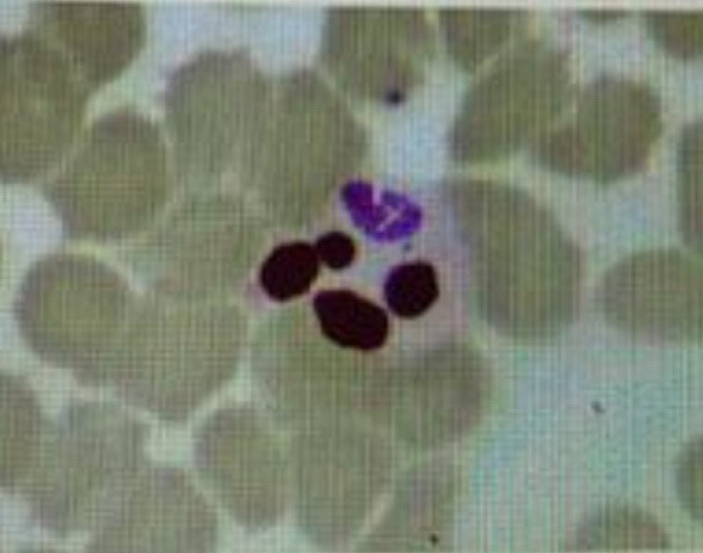 <p>How is the pathogen illustrated transmitted?</p>