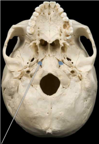 The highlighted openings are a component of which bones? A paired opening in the base of the skull between the occipital, sphenoid, and temporal bones