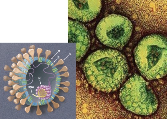 <p>Genus: Coronavirus</p>