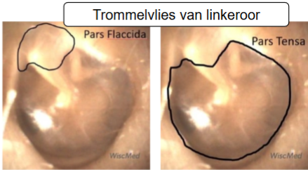 <p>trommelvlies: wat, delen</p>