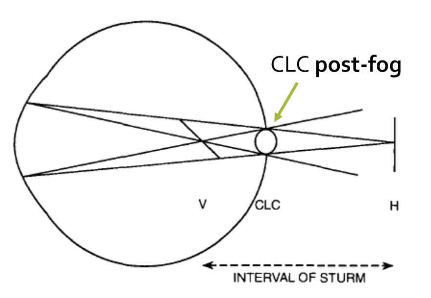<p>Places the CLC at the outer limiting membrane (OLM) of retina. This step is accomplished during STEP 1<br>GROSS SPHERE DETERMINATION </p>
