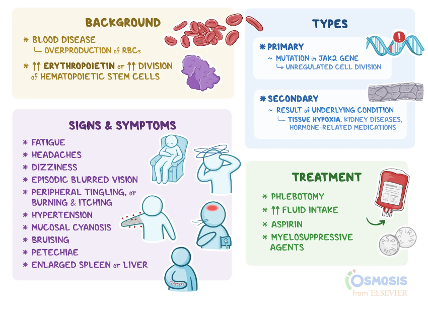 <p>Det är en <strong>erytrocytos</strong> → för mycket erytrocyter i blodet → förhöjt Hb eller hematokrit. Hos 95% av patienter finns en mutation i <strong>JAK2.</strong> Det gör att blodet blir hyperviskost. </p><p>Symptom:</p><ul><li><p>Erytrocytos → (normalt EPO)</p></li><li><p>Leukocytos: basofiler och neutrofiler</p></li><li><p>Hematokrit högt</p></li><li><p>Hypertoni</p></li><li><p>Splenomegali</p></li><li><p>Blödningar eller trombos</p></li><li><p>Trötthet</p></li><li><p>Huvudvärk</p></li></ul><p>PV kan utvecklas till <strong>myelofibros</strong> eller <strong>AML</strong>. </p>