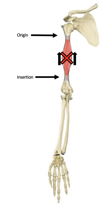 <p></p><ul><li><p><span>&nbsp;</span>Usually the distal end</p><img src="https://knowt-user-attachments.s3.amazonaws.com/a0720d27-e21b-4a29-b702-f2180cc3bfcb.png" data-width="100%" data-align="center"></li></ul><p></p>