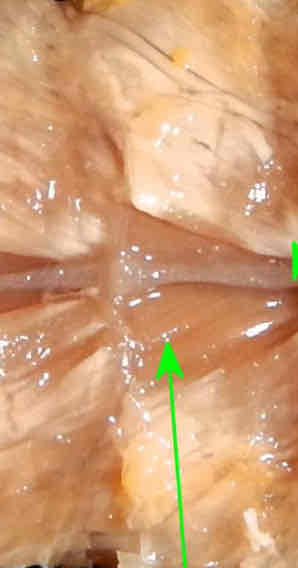 <p>Identify this structure</p>