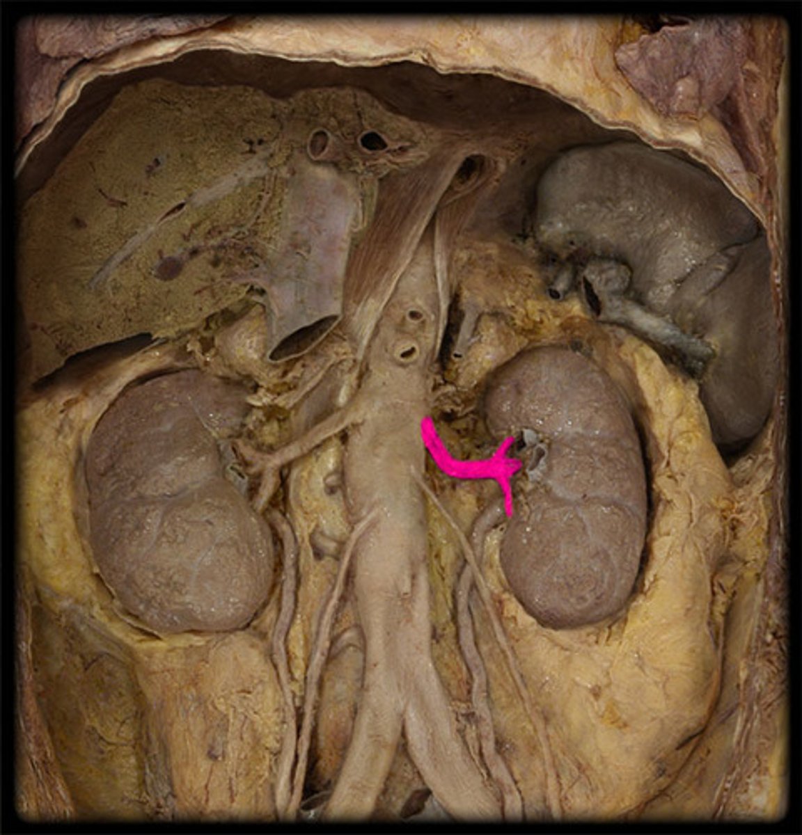 <p>-blood supply to and from the kidneys</p><p>-artery in beneath vein</p><p>-artery is rounder</p>