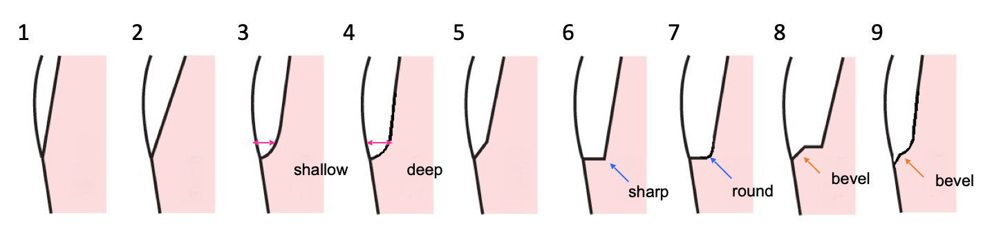 <p>which margin designs and related bur shape? </p>