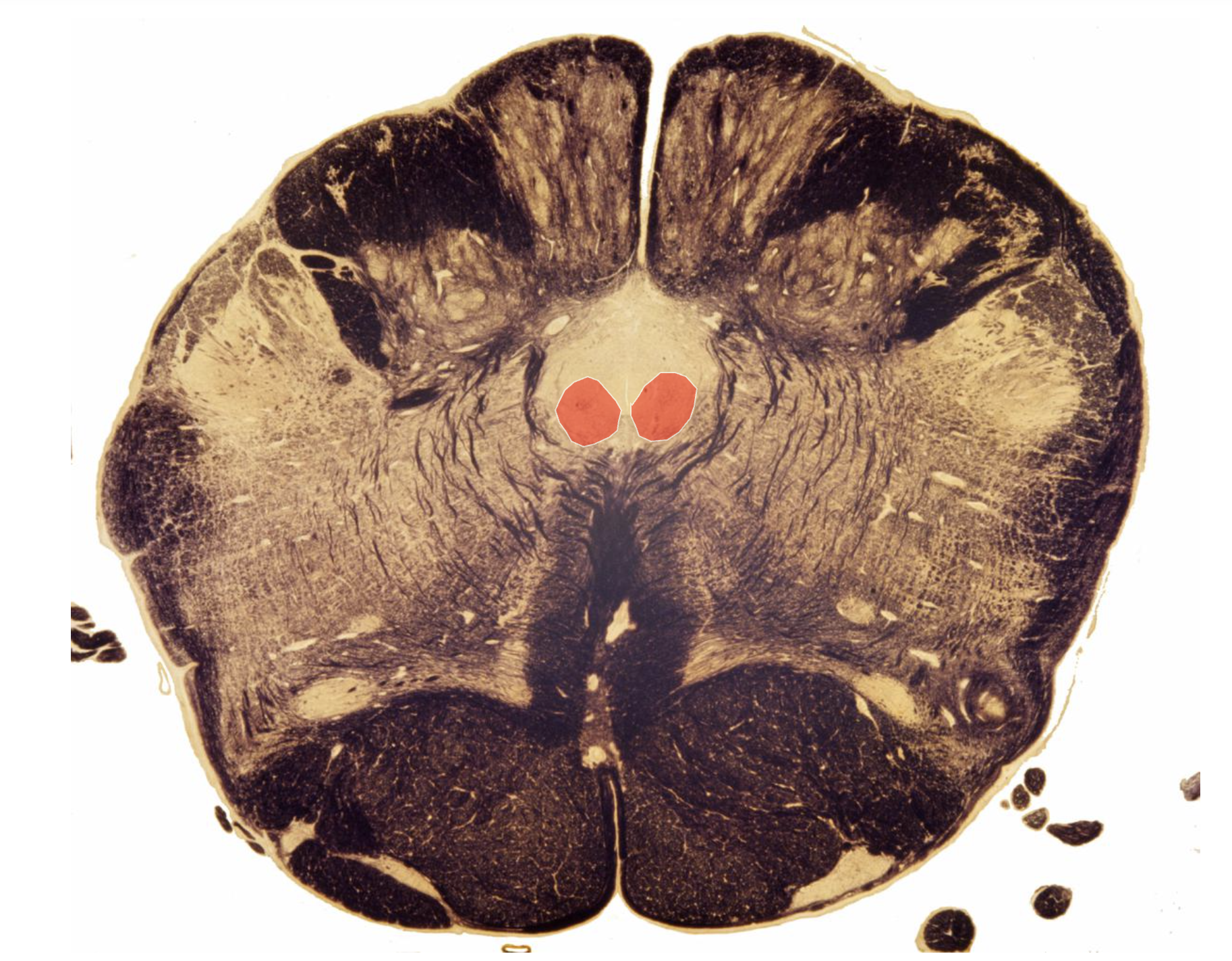 <p>Hypoglossal Nucleus</p><p></p><p>Innervation of Tongue Muscles (Speech &amp; Mastication)</p><p></p><p><strong>Always Close to the Center</strong></p>
