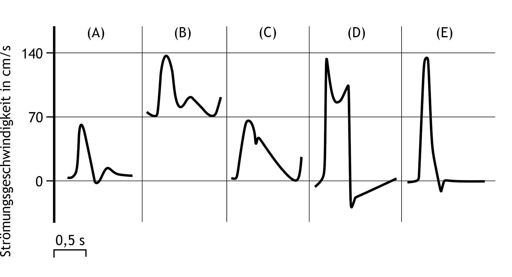 <p>40. Which of the following curves (A) to (E) best represents the time- and amplitude-correct flow profile of blood in the ascending aorta?</p><p>A. (A)</p><p>B. (B)</p><p>C. (C)</p><p>D. (D)</p><p>E. (E)</p>