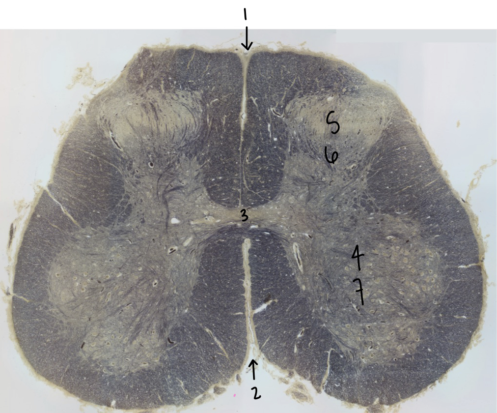 <p>What structure is labeled 1?</p>