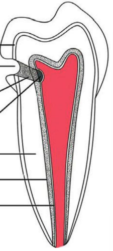 <p>Label the basic layers of dentine</p>