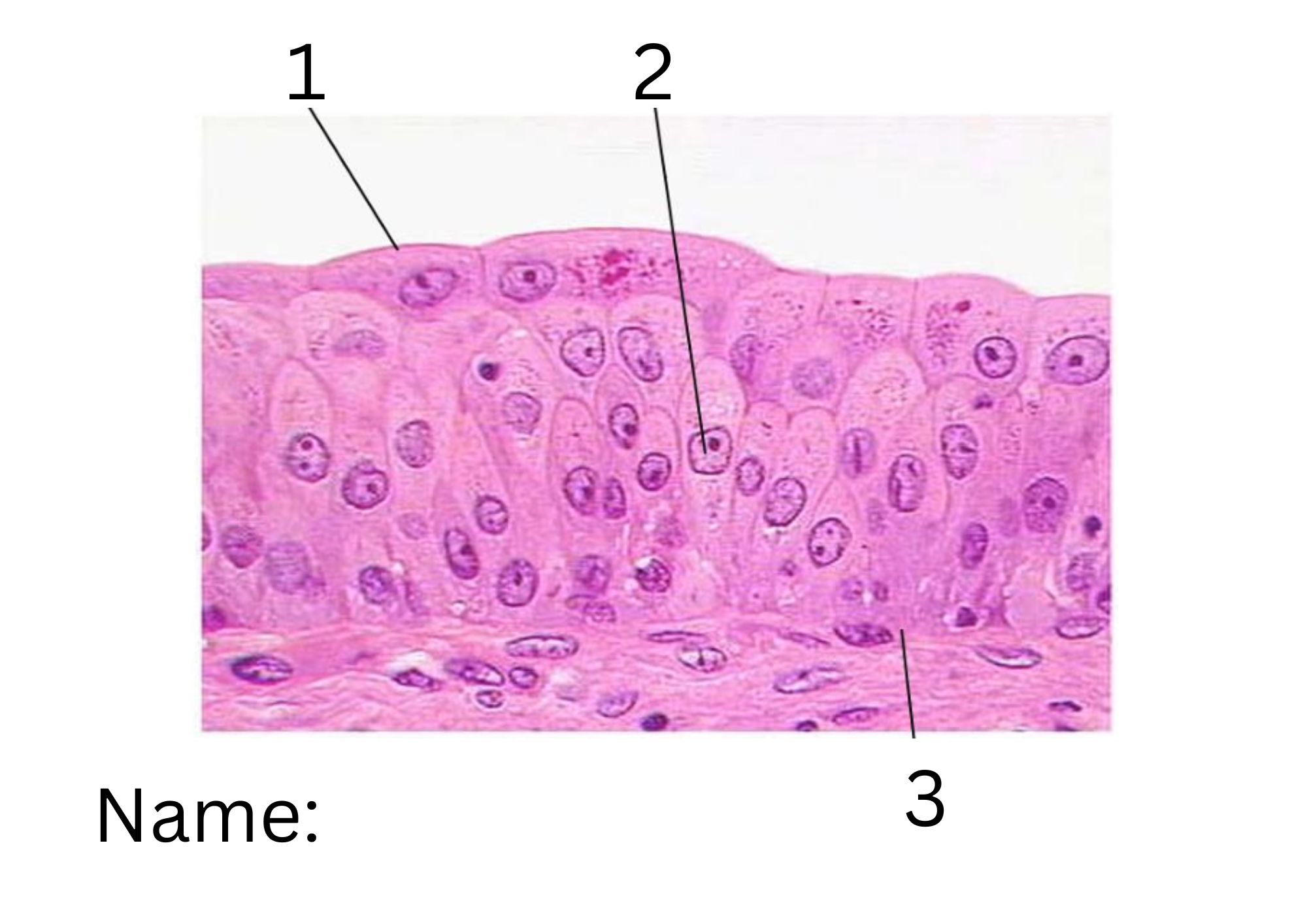 term image