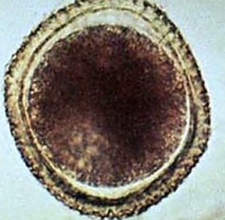 <p>Give the genius, species and common name for this <strong>canine</strong> parasitic egg</p>