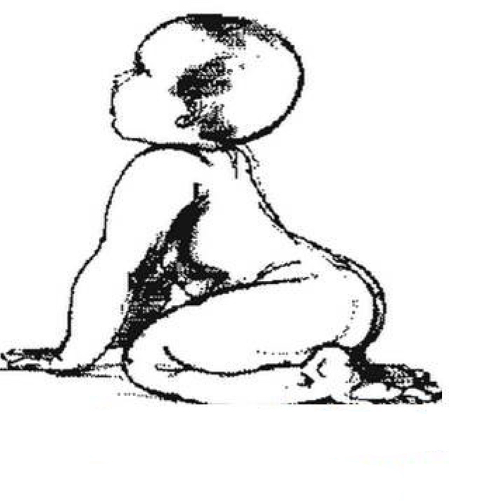 <p>This is an example of what reflex…</p>