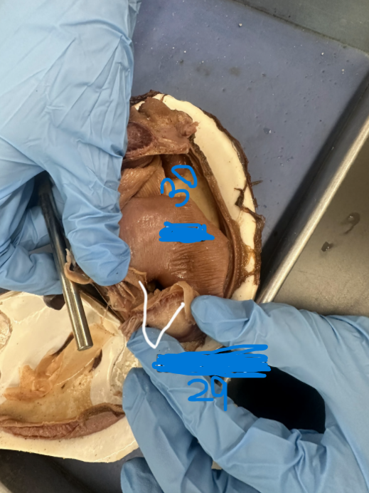 <p>What is option 30</p>